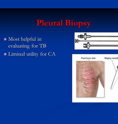 Pleural Biopsy